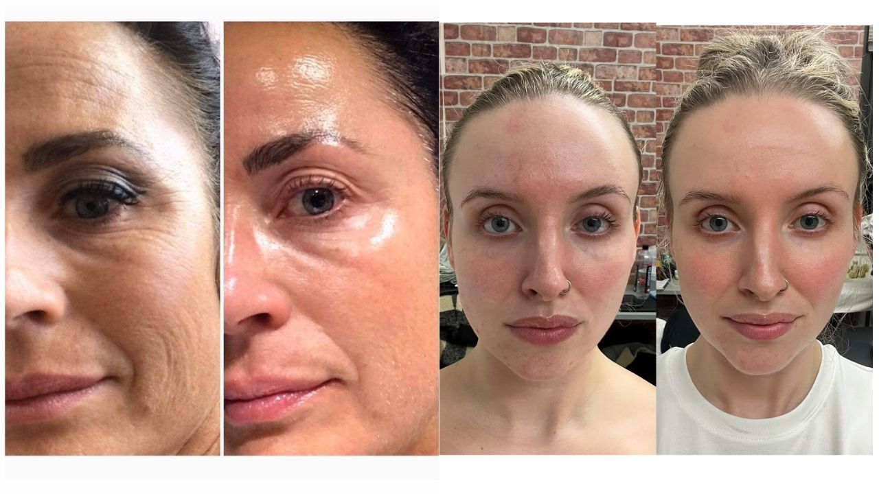 Técnica de masaje facial con gua sha